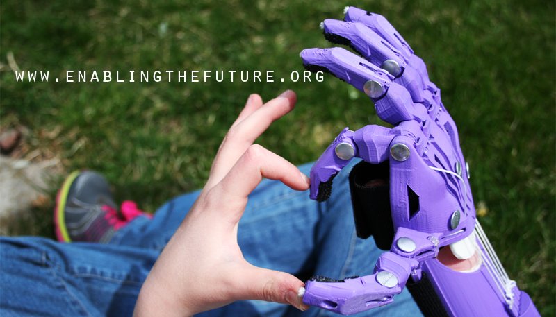 E-Nable Revolutionizes Prosthetic Industry with 3D Printing